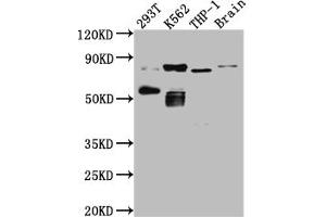 Western Blot Positive WB detected in: 293T whole cell lysate, K562 whole cell lysate, THP-1 whole cell lysate, Mouse Brain whole cell lysate All lanes: PKC antibody at 1:1000 Secondary Goat polyclonal to rabbit IgG at 1/50000 dilution Predicted band size: 82, 75, 68 kDa Observed band size: 82, 55 kDa
