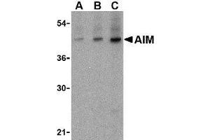 Western blot analysis of AIM in human lymph node tissue lysate with AP30035PU-N AIM antibody at (A) 1, (B) 2 and (C) 4 μg/ml. (CD5L anticorps  (N-Term))