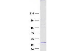 Validation with Western Blot
