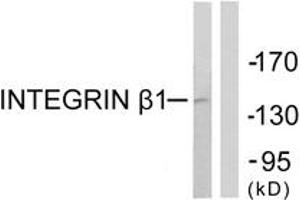 Western blot analysis of extracts from Jurkat cells, using Integrin beta1 (Ab-789) Antibody. (ITGB1 anticorps  (AA 746-795))