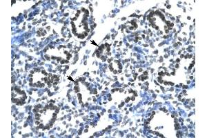 Claudin 17 antibody was used for immunohistochemistry at a concentration of 4-8 ug/ml to stain Alveolar cells (arrows) in Human Lung.
