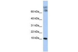 Image no. 1 for anti-Chemokine-Like Factor (CKLF) (N-Term) antibody (ABIN6741007) (CKLF anticorps  (N-Term))