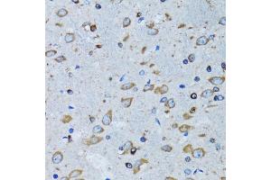 Immunohistochemistry of paraffin-embedded mouse brain using RARS antibody (ABIN6127449, ABIN6146708, ABIN6146709 and ABIN6221913) at dilution of 1:100 (40x lens).