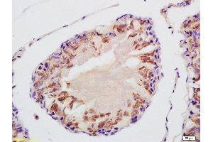 Formalin-fixed and paraffin embedded rat testis labeled with Anti-VDAC3 Polyclonal Antibody, Unconjugated  at 1:200 followed by conjugation to the secondary antibody and DAB staining