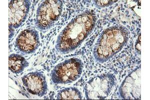 Image no. 1 for anti-serine/threonine Kinase 38 Like (STK38L) (AA 1-281) antibody (ABIN1490700)