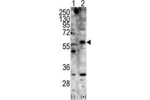 Western blot analysis of STK11 (arrow) using rabbit polyclonal STK11 Antibody . (LKB1 anticorps  (N-Term))