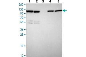 Western blot analysis of ZC3HAV1 polyclonal antibody . (ZC3HAV1 anticorps)