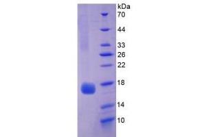 SDS-PAGE of Protein Standard from the Kit  (Highly purified E. (Myoglobin Kit ELISA)