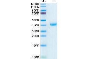 Biotinylated Human CD161 on Tris-Bis PAGE under reduced condition.