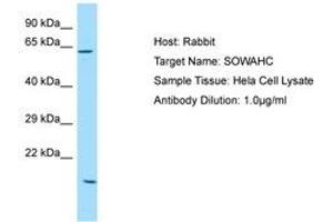 Image no. 1 for anti-Ankyrin Repeat Domain 57 (ANKRD57) (AA 425-474) antibody (ABIN6750152)