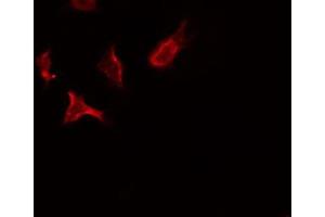 ABIN6275847 staining HeLa by IF/ICC. (STK10-A anticorps  (Internal Region))
