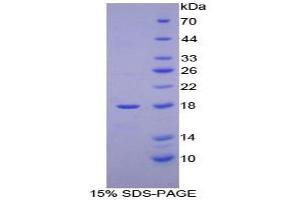 SDS-PAGE analysis of Human Hemoglobin Mu Protein.