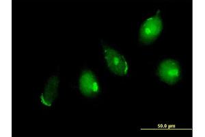 Immunofluorescence of purified MaxPab antibody to GOLGA5 on HeLa cell.