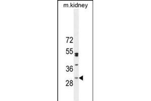 C Antibody (Center) (ABIN654951 and ABIN2844592) western blot analysis in mouse kidney tissue lysates (35 μg/lane). (C6ORF62 anticorps  (AA 118-147))