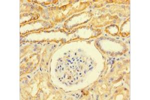 Immunohistochemistry of paraffin-embedded human kidney tissue using ABIN7153793 at dilution of 1:100 (GTF2F1 anticorps  (AA 1-249))