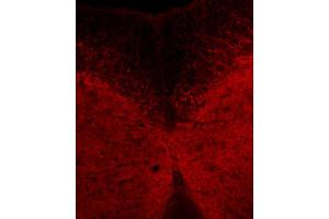 Immunohistochemistry (IHC) image for anti-Nicotinic Acetylcholine Receptor beta (CHRNB1) antibody (ABIN1742452) (CHRNB1 anticorps)