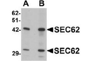 Western blot analysis of SEC62 in rat brain tissue lysate with SEC62 antibody at (A) 0. (SEC62 anticorps  (C-Term))