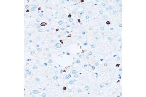 Immunohistochemistry of paraffin-embedded human liver using SPN antibody.