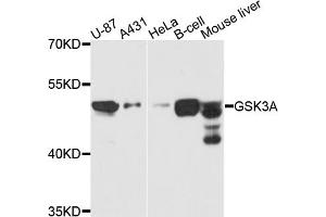 Western blot analysis of extracts of various cell lines, using GSK3A antibody (ABIN5970240) at 1/1000 dilution. (GSK3 alpha anticorps)