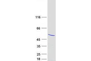 Validation with Western Blot