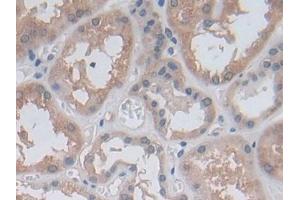 Detection of MTHFR in Human Kidney Tissue using Polyclonal Antibody to Methylenetetrahydrofolate Reductase (MTHFR)