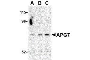 Western Blotting (WB) image for anti-ATG7 Autophagy Related 7 (ATG7) (C-Term) antibody (ABIN2477539) (ATG7 anticorps  (C-Term))