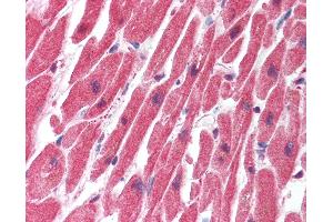 Anti-SERTAD1 antibody IHC of human heart. (SERTAD1 anticorps  (N-Term))