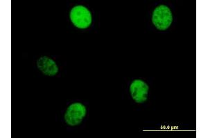 Immunofluorescence of purified MaxPab antibody to KIF23 on HeLa cell.