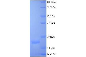 SDS-PAGE (SDS) image for Mismatch Repair Protein 2 (MSH2) (AA 139-311) protein (His tag) (ABIN5713370)
