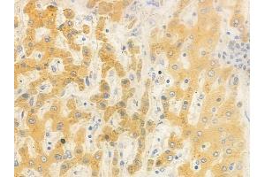 ABIN6262446 and ABIN6278479 at 1/100 staining human normal liver tissue by IHC-P. (IDH3B anticorps  (N-Term))