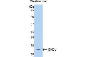 Western blot analysis of the recombinant protein. (Annexin IV anticorps  (AA 165-260))