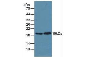Western blot analysis of (1) Mouse Heart Tissue and (2) Rat Heart Tissue. (MAPK14 anticorps  (AA 19-279))