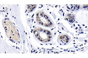 anti-Ataxia Telangiectasia Mutated (ATM) (AA 2484-2748) antibody