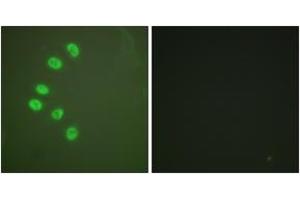 Immunofluorescence analysis of A549 cells, using Progesterone Receptor (Ab-294) Antibody. (Progesterone Receptor anticorps  (AA 261-310))