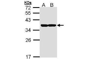WB Image Sample (30 ug of whole cell lysate) A: Molt-4 , B: Raji 12% SDS PAGE antibody diluted at 1:1000 (XBP1 anticorps)