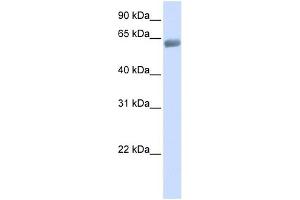 SLC47A2 antibody used at 1 ug/ml to detect target protein. (SLC47A2 anticorps  (C-Term))