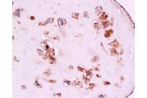 Formalin-fixed and paraffin embedded human placenta tissue labeled with Anti-CD105 Polyclonal Antibody, Unconjugated at 1:200, followed by conjugation to the secondary antibody and DAB staining (Endoglin anticorps  (AA 601-658))