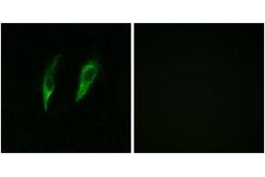 Immunofluorescence analysis of HeLa cells, using IRAK3 Antibody. (IRAK3 anticorps  (AA 491-540))