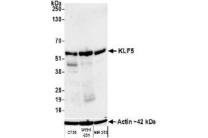 Western Blotting (WB) image for anti-Kruppel-Like Factor 5 (Intestinal) (KLF5) (AA 325-375) antibody (ABIN7795630)