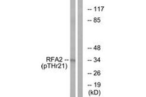 Western blot analysis of extracts from HeLa cells treated with Adriamycin 0. (RPA2 anticorps  (pThr21))