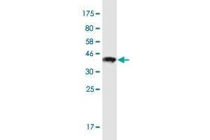 Western Blot detection against Immunogen (36. (POTED anticorps  (AA 485-584))