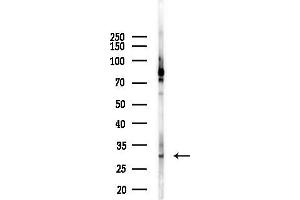 Western blot analysis of lysates from K562 cells(heat-shock 45 min treatment), using VDAC1 Antibody at 1/1000 dilution.
