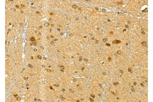 ABIN6265848 and ABIN6277175 at 1/100 staining Rat brain tissue by IHC-P. (UBE2I anticorps  (N-Term))