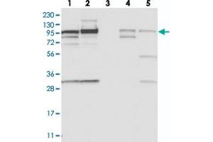 Western blot analysis of Lane 1: RT-4, Lane 2: U-251 MG, Lane 3: Human Plasma, Lane 4: Liver, Lane 5: Tonsil with SCARF2 polyclonal antibody  at 1:250-1:500 dilution. (SCARF2 anticorps)