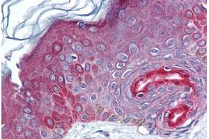 Human Skin (formalin-fixed, paraffin-embedded) stained with FAM3C antibody ABIN293839 at 5-10 ug/ml followed by biotinylated goat anti-rabbit IgG secondary antibody ABIN481713, alkaline phosphatase-streptavidin and chromogen. (FAM3C anticorps  (AA 40-80))