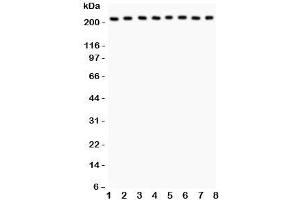 Western blot testing of Integrin alpha 5 antibody and Lane 1:  rat brain;  2: mouse brain;  3: human MM231;  4: (h) HeLa;  5: (h) Jurkat;  6: (h) 293T;  7: (m) Neuro-2a;  8: (r) PC12 lysate;  Expected size: 115-160KD;  Observed size: 220KD (ITGA5 anticorps  (AA 787-992))