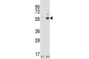 Western blot analysis of ICAM-1 antibody and 293 cell lysate (2 ug/lane) either nontransfected (Lane 1) or transiently transfected with the ICAM1 gene (2).
