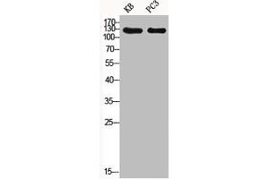 Western Blot analysis of KB PC-3 cells using Phospho-SHIP-1 (Y1021) Polyclonal Antibody