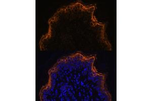 Immunofluorescence analysis of rat skin using SPRR1A antibody (ABIN7270369) at dilution of 1:100.