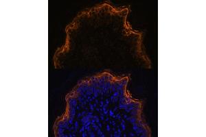Immunofluorescence analysis of rat skin using SPRR1A antibody (ABIN7270369) at dilution of 1:100. (SPRR1A anticorps)